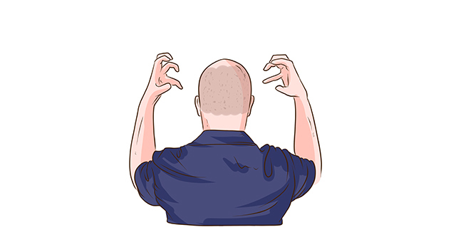 植发,不想被“套路”,这样做!