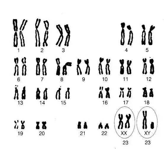 【11個經典案例】解讀人類染色體核型分析報告