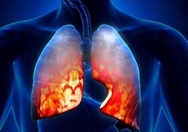 肺部发出的“求救”的信号,除了咳嗽还有这些!大部分人都不知道