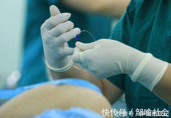 次数|女性的子宫能“扛”几次剖腹产超过这个次数,千万不要再剖了