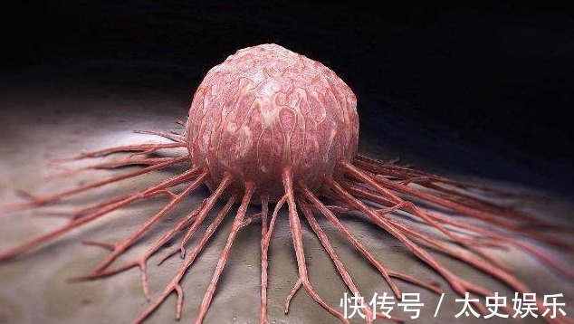 癌变|不想身体垮掉,远离这3种食物!常吃是在为癌变打基础,尽量戒掉