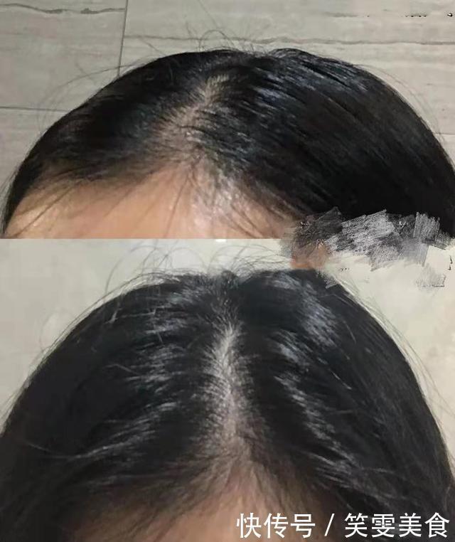 怎样烫发头顶蓬松,3种方法让你发量翻倍,告别扁塌发