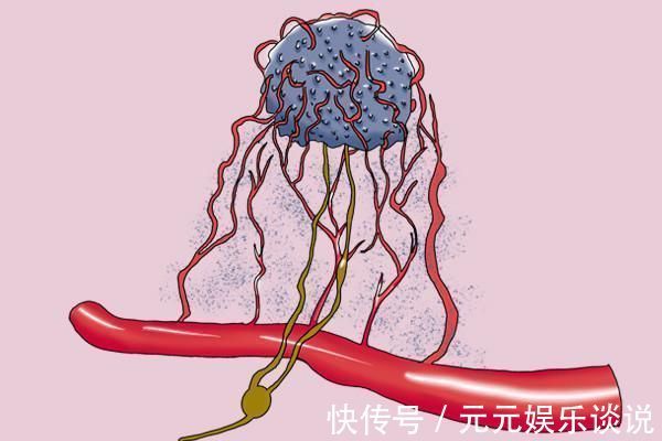 几率|前列腺肥大,发展成前列腺癌的几率有多大?医生告诉你实话