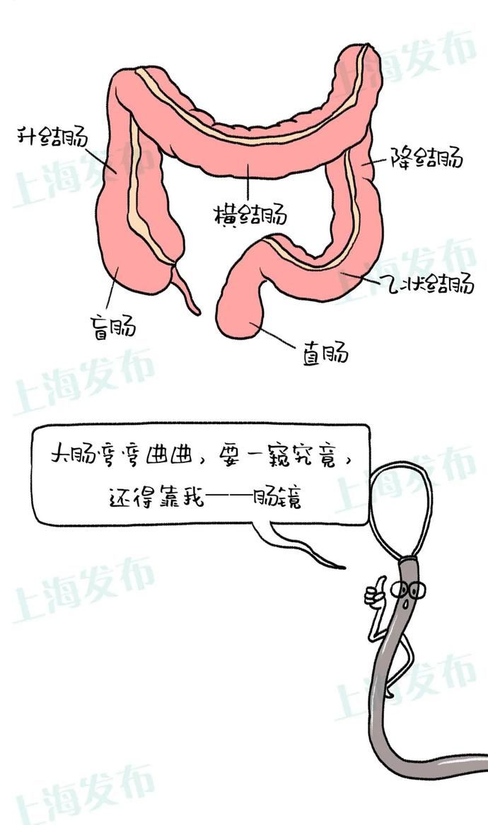 麻醉|【医聊】肠息肉是怎么长出来的?要不要割?