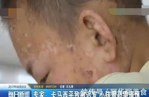 家长|别再随意把成人药给孩子吃了吃药导致住院,坑了孩子后悔来不及