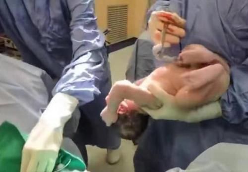 分娩|一组图带你了解:宝宝出生后,被医生抱走的神秘十分钟都经历了啥