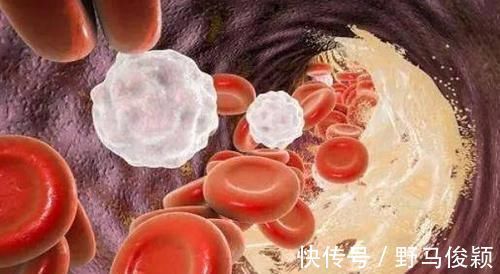 百病|中医直言血管一堵，易生百病，常吃5种蔬菜血管不再堵，别错过