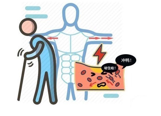 动脉粥样硬化|脑供血不足头晕,应如何护理?不妨多吃5种食物,有助血管健康