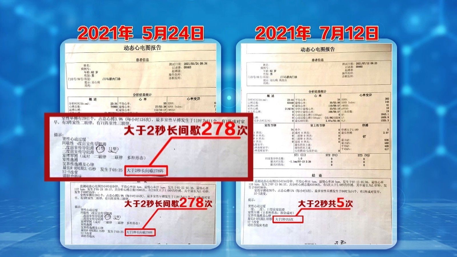 主任医师|《养生堂》17:25 播出《冬季进补“药”得法——鹿药》