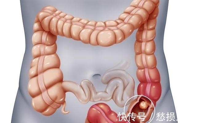 寿命|50岁是寿命决定期，长寿还是短寿，4个症状“一目了然”