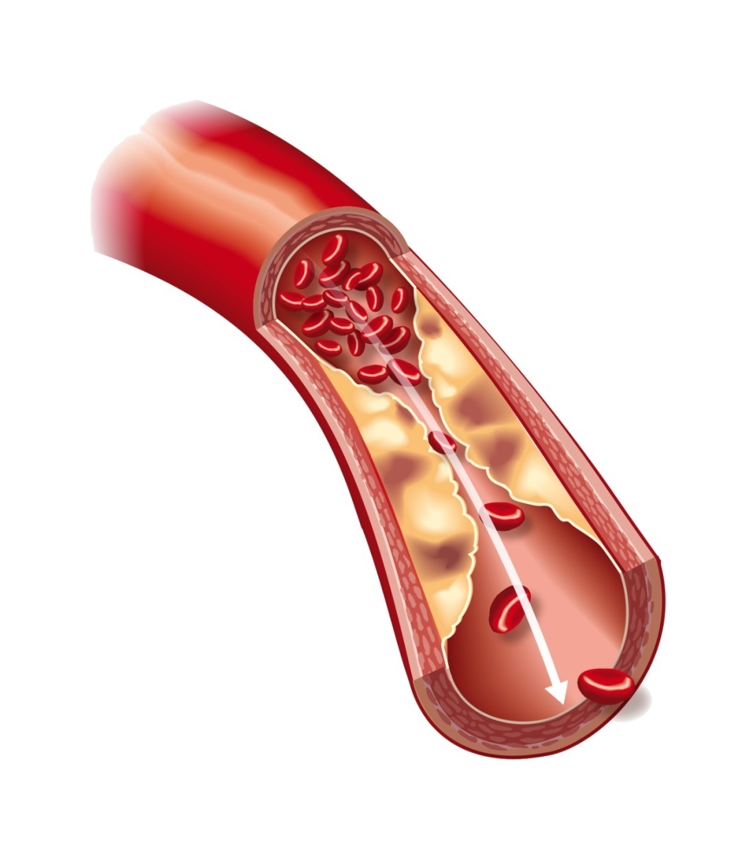 猪油到底对身体好还是坏别争了,真相来了