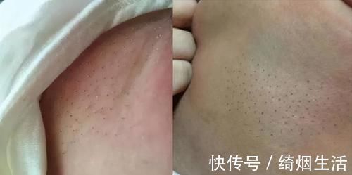 宝妈|宝宝夜里哭闹不止,用梳子刮一刮就好了?别让你的无知“害了”娃