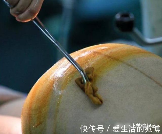 产后恢复|剖腹产时,能让医生顺便割掉点“脂肪”吗?大多数人难想到