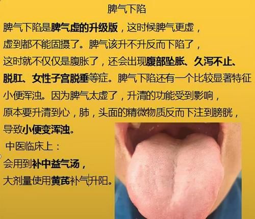 神疲乏力|脾气虚、脾阳虚，这6种脾虚，从初级到严重，你是属于哪一种？