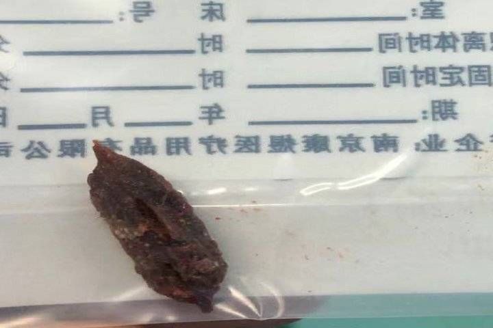 健康过春节|耳鼻咽喉头颈颅底外科:谨防食管异物及小儿气管异物