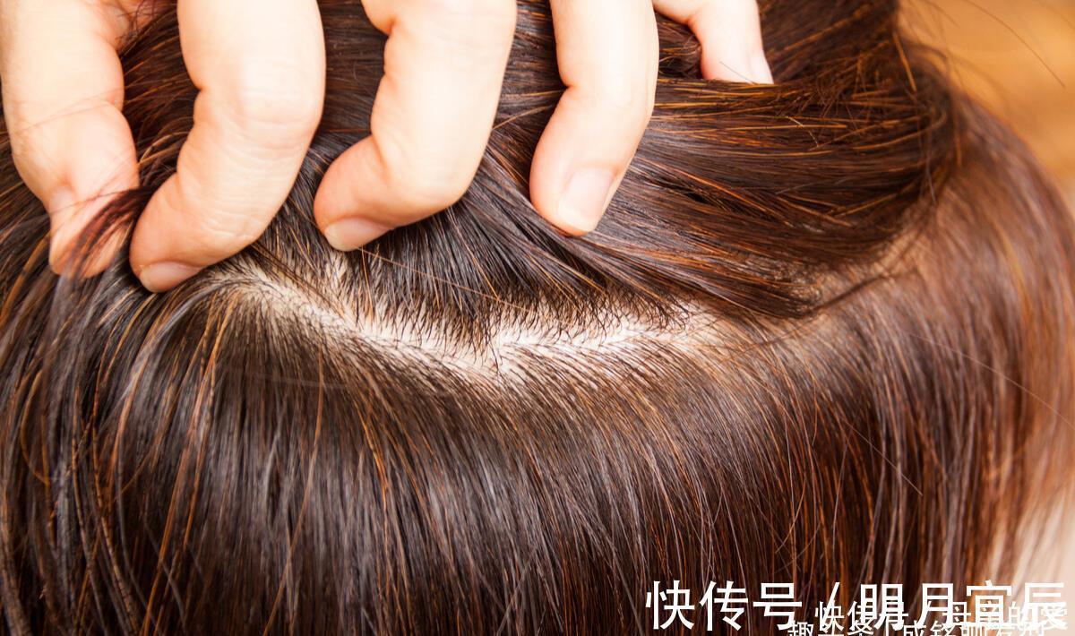 染发|头发染什么颜色,过敏风险最小?做好皮肤测试,才能放心染发