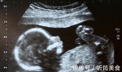 医院|每次产检结果正常,孩子生出后发现畸形,医院需要负责吗?