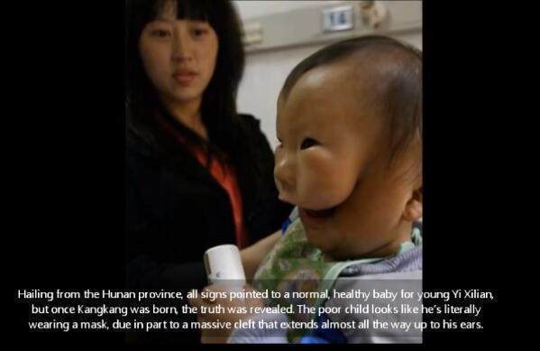 康康|宝宝安全出生,可妈妈看到宝宝的样子失声痛哭!