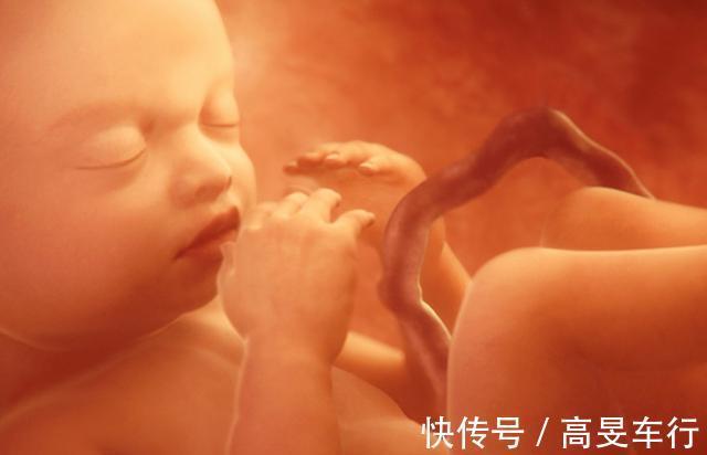 胎动|十月怀胎,这个周是胎儿脐带绕颈“高发期”,孕妇要早知道早预防