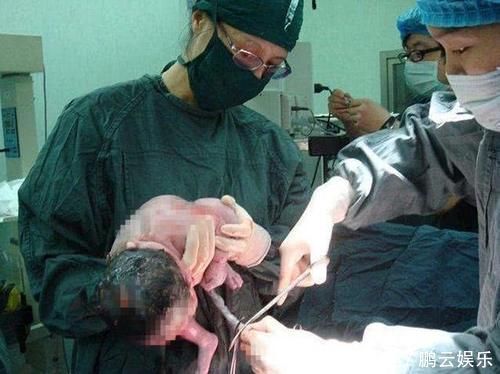 脐带|新生儿出生后的10多分钟,到底在“折腾”些啥其实他比妈妈忙