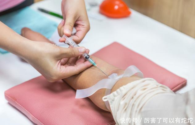 医生提醒:甘油三酯过高的人,这2种素食尽量少吃,以免升高血脂