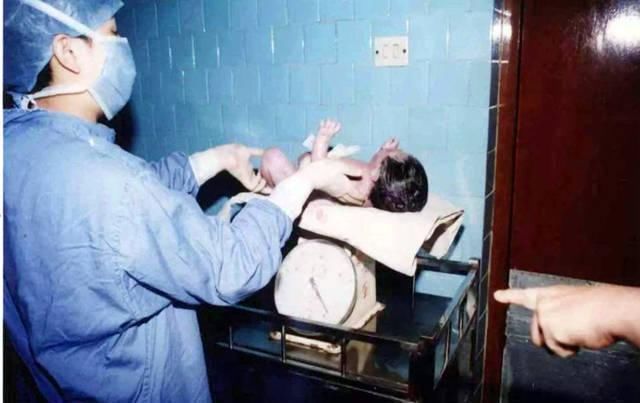 试管婴儿|国内首例试管婴儿已31岁,现状让不少人失望了,好处不得不提