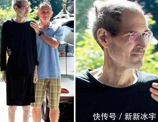 患者|癌症晚期的患者会遭受哪些痛苦,应该怎么办告诉你真相