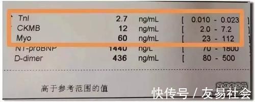 硝甘|从“上火”到心肌死亡仅5天！牢记16个字，必要时能救命