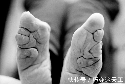 陋习@古代男子的畸形审美三寸金莲,从铁莲、银莲到金莲!