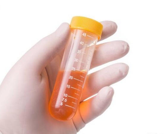 肝病|肝不好的人,保温杯里泡两朵,排肝毒,壮肝阳,肝脏悄悄变好