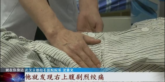 医院|连吃几天螃蟹，男子竟进了医院！医生提醒：这类人千万注意