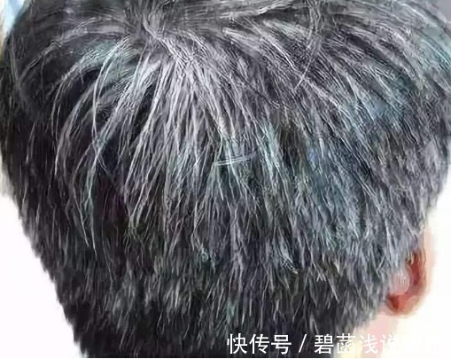 膀胱|白发与身体的关系,后悔现在才知道!附带防治的方法哦!快收藏