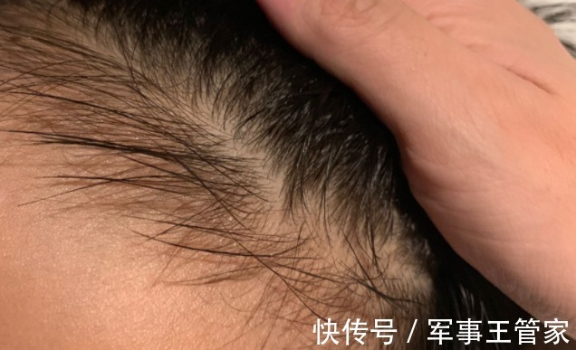 兴奋|宝宝睡觉时头上有“汗珠”，只是因为“缺钙”吗？家长需了解真相