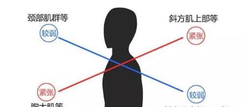 含胸 驼背 颈肩痛 小心上交叉综合症找上你 快资讯