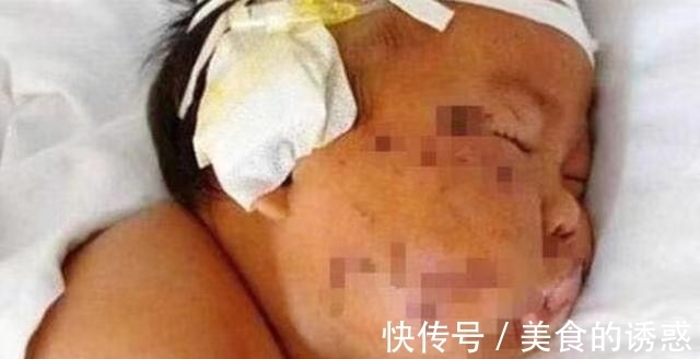 情绪|因吃奶咬疼妈妈，脸被妈妈刺成“大花猫”的男婴，4年后怎样了？