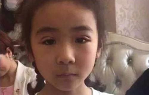 亲妈为让女儿更漂亮,带5岁的女儿割双眼皮,网友不配为人母