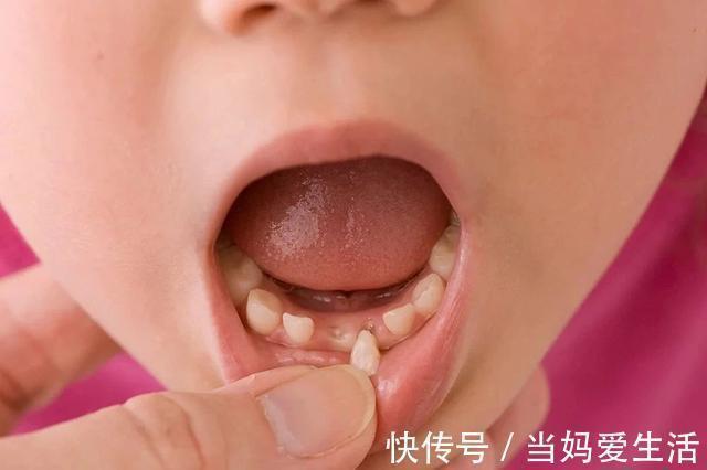 消毒|孩子这颗牙有大“作用”，父母别再乱丢了，关键时刻能救娃一命
