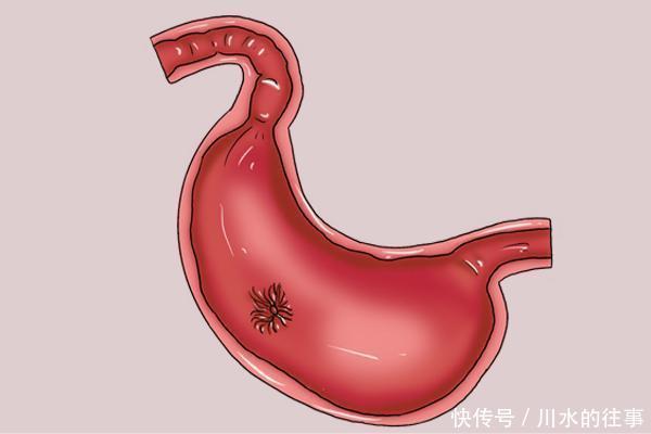 不只补气,黄芪还有4大好处,但怎么喝更有效,还防上火告诉你