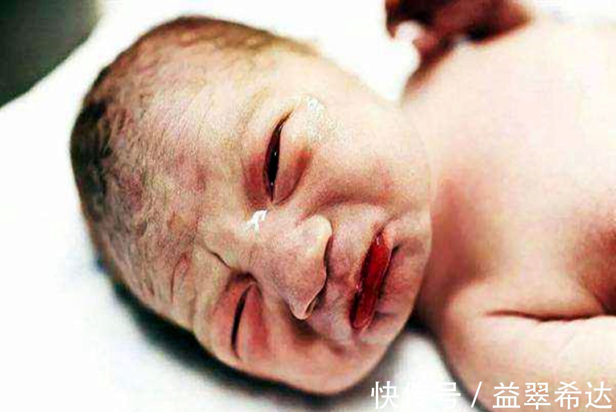 孕妈们|娘胎里“整容”是什么体验?医生:孕期注意,你的孩子也不会丑