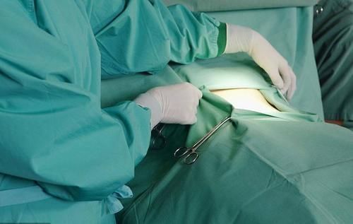 抽脂手术的伤害有多大？没有想象的那么恐怖，看完涨知识了