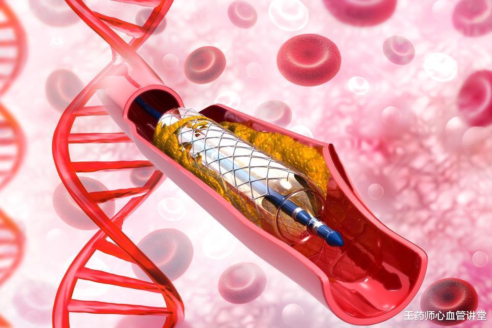 冠心病患者|侧支循环助冠心病更长寿！83岁的周叔，现身说法，分享3条经验