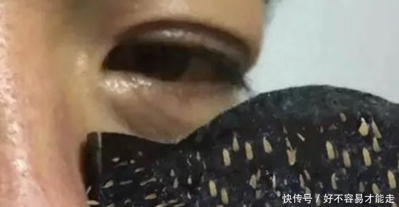 草莓鼻|女生“黑头”反反复复?睡前若能坚持3习惯,“草莓鼻”再也与你无缘!