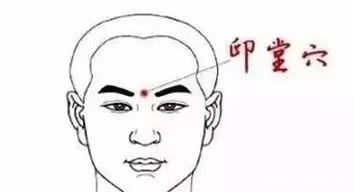 针灸大成|夹虎口治偏头痛有奇效？按摩穴位可缓解疼痛但不能盲从