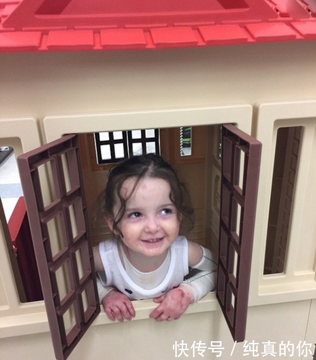 父母|父母每天将三岁女儿包裹成木乃伊,网友知道真相后感动落泪!