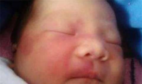 孕妇|孕妇最忌讳的就是做这样的事情,小心宝宝出生后满身胎记