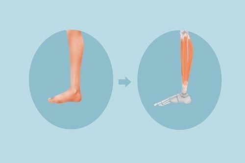 补钙|睡觉腿抽筋，是缺钙吗？4种病也可能引起抽筋，别盲目补钙