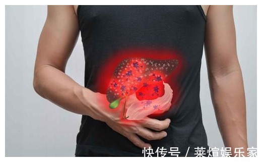 黄疸黄疸|42岁男子,肝硬化到肝功正常,只用了1年,平时爱吃“1红”是关键