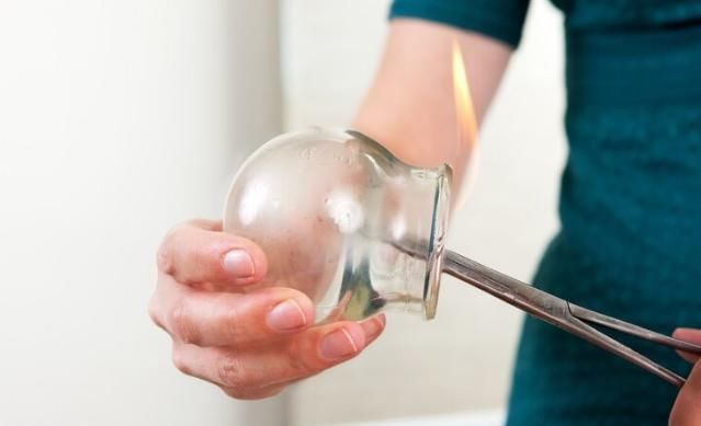 免疫细胞|年轻小伙拔罐治颈椎病,反把右肺吸没?中医:3类人不该拔罐