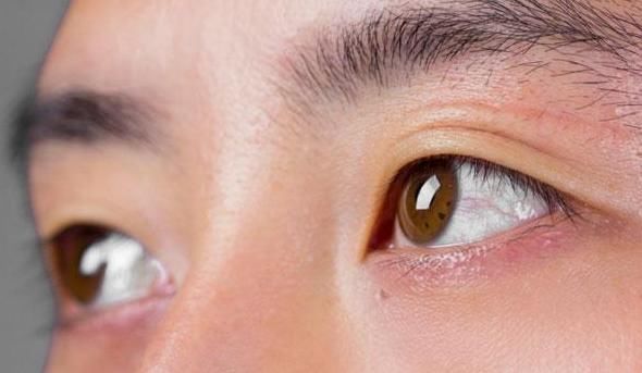 眼皮总是跳,是不幸的征兆吗不要再迷信了,小心错过身体信号