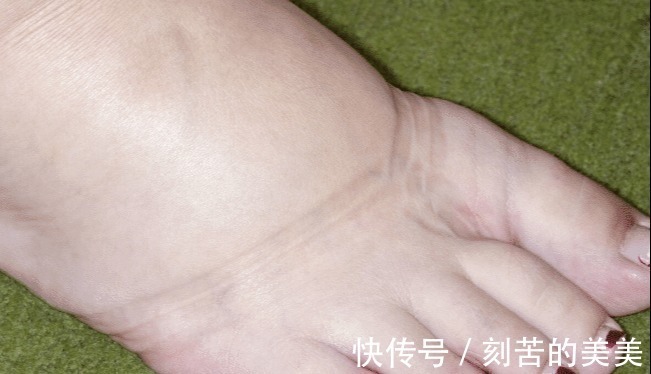 心跳骤停|连吃5个橘子,34岁女子心跳骤停,药师提醒高血压要千万注意!